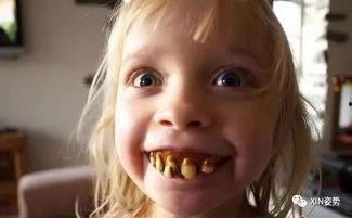 龅牙吃瓜搞笑,欢乐无限，搞笑日常大揭秘！  第3张